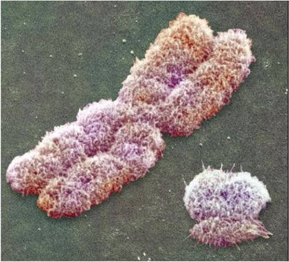 chromosome photo