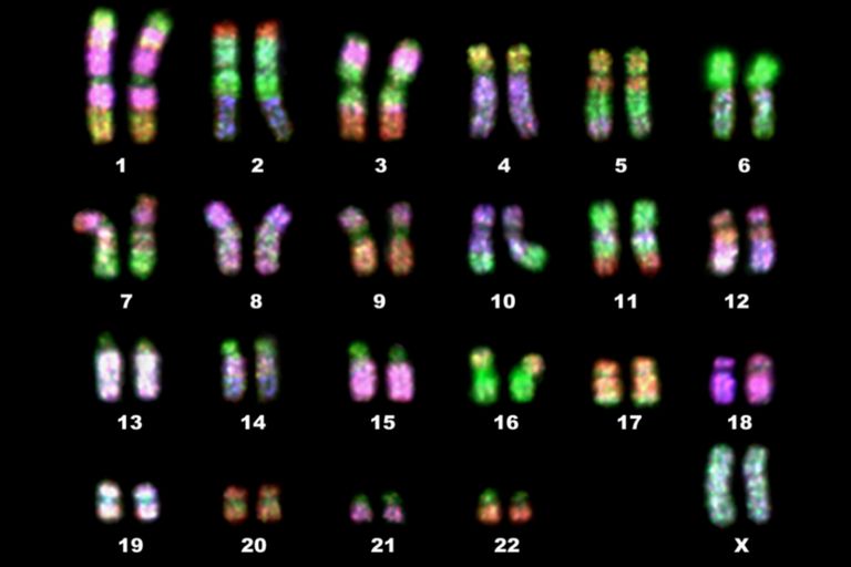 caryotype feminin